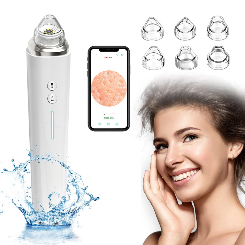 [Australia] - Blackhead Remover Vacuum with Camera, Visible Acne Comedone Extractor Kit with 20X HD Camera, WIFI Blackhead Pimple Extractor Vacuum for Android iPhone with 6 Suction Probes for Women and Men White 