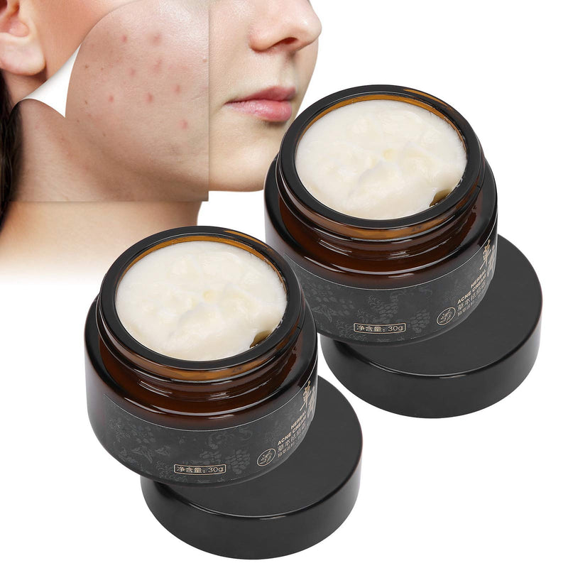 [Australia] - Herbal Acne Cream, Control Oil Remove Acne, Anti‚ÄëAcne Soothing Repairing Face Cream 