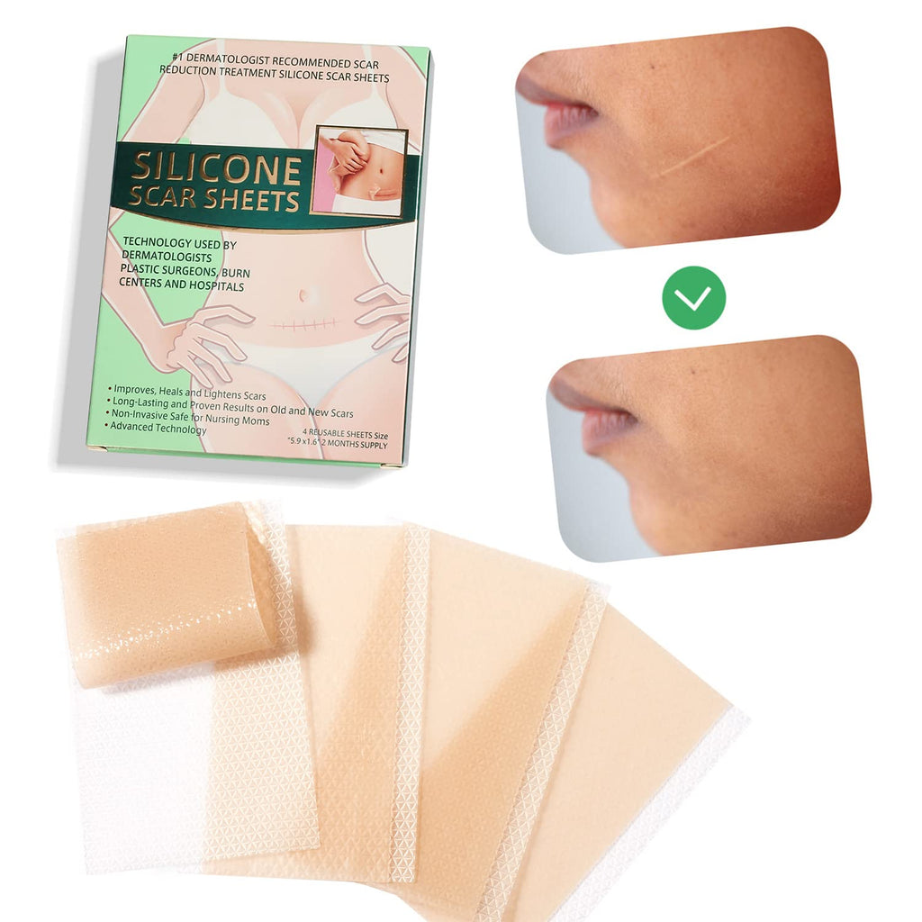 [Australia] - Silicone Scar Removal Leaves, Scar Reduction, Treat New and Old Scars, Quickly and Effectively Removes Scars for Acne Scars, Stretch Marks, Burning, Pack of 4 A 
